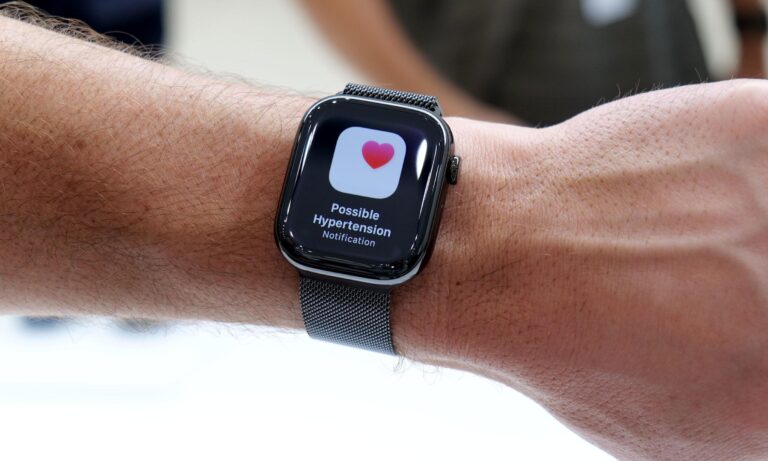 Уведомления о гипертонии — Apple Watch Series 11