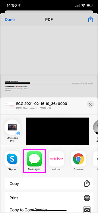 Скриншот: пример отправки ЭКГ врачу через общий доступ