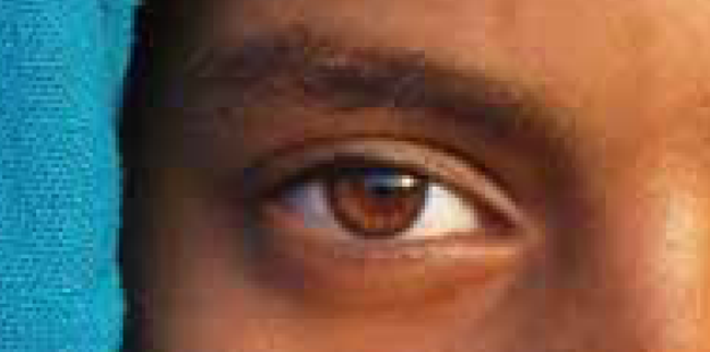 Imagen mostrando mosaicos y artefactos en el ojo