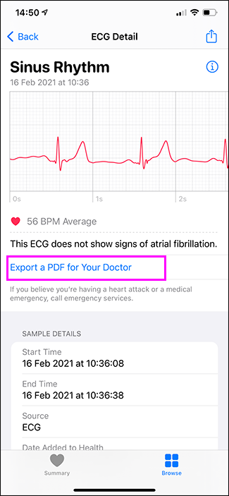 Скриншот: одиночная запись ЭКГ в приложении «Здоровье»