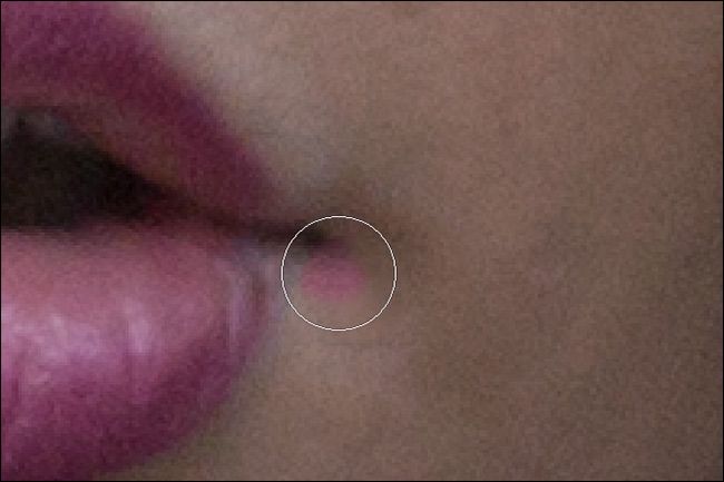 Проблема автоматического восстановления рядом с губами