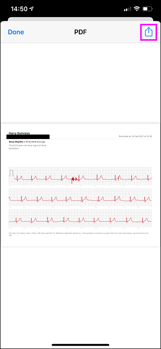 Скриншот: PDF ЭКГ и иконка общего доступа